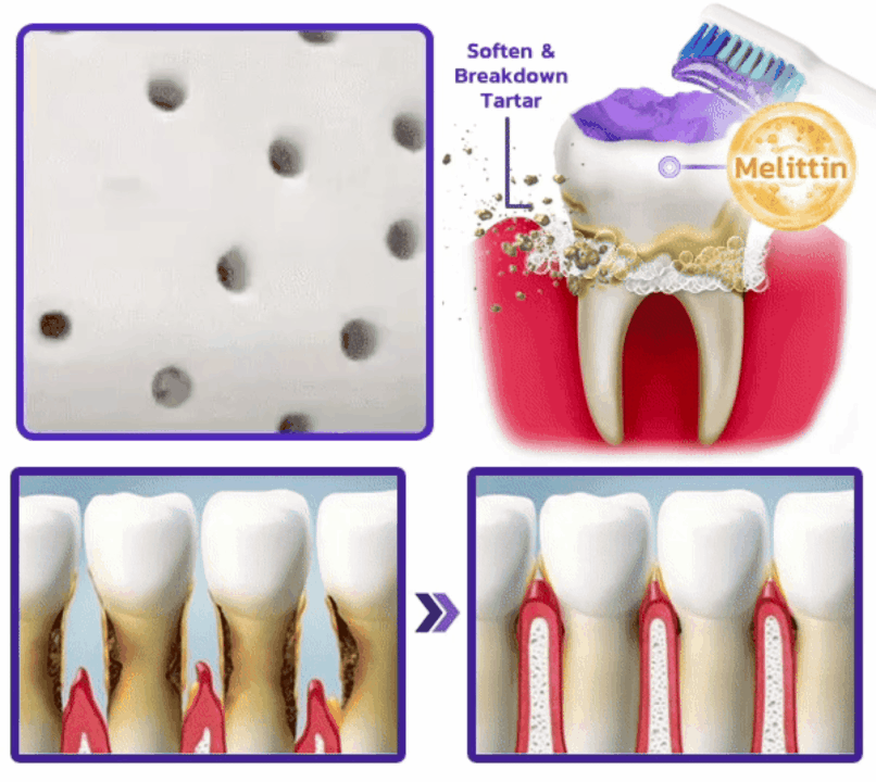 ๐ฆท๐๐๐ญ๐ซ๐๐ฏ๐จ๐ซยฎ VioCore Bee Venom Gingivitis & Periodontitis Treatment Toothpaste