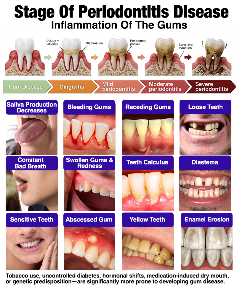 𝐍𝐚𝐭𝐫𝐚𝐯𝐨𝐫® VioCore Bee Venom Gingivitis & Periodontitis Treatment Toothpaste