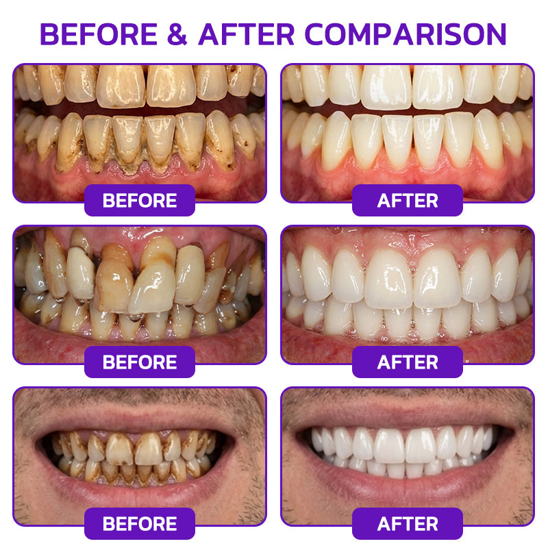 𝐍𝐚𝐭𝐫𝐚𝐯𝐨𝐫® VioCore Bee Venom Gingivitis & Periodontitis Treatment Toothpaste