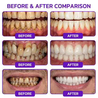 𝐍𝐚𝐭𝐫𝐚𝐯𝐨𝐫® VioCore Bee Venom Gingivitis & Periodontitis Treatment Toothpaste