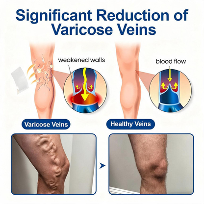 🇺🇸👨‍⚕️🦵✅𝐍𝐚𝐭𝐫𝐚𝐯𝐨𝐫® VeinTarget Microneedle Patch⚡Instant Relief, Long-Term Results