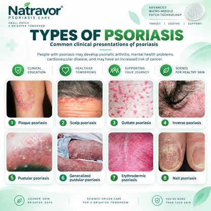 🔥 Only 10 left! Get 30% OFF your second purchase! Natravor® helps reduce visible scaling, redness, dryness & itching while supporting psoriasis-prone skin. Limited stock — don’t miss out! 💚