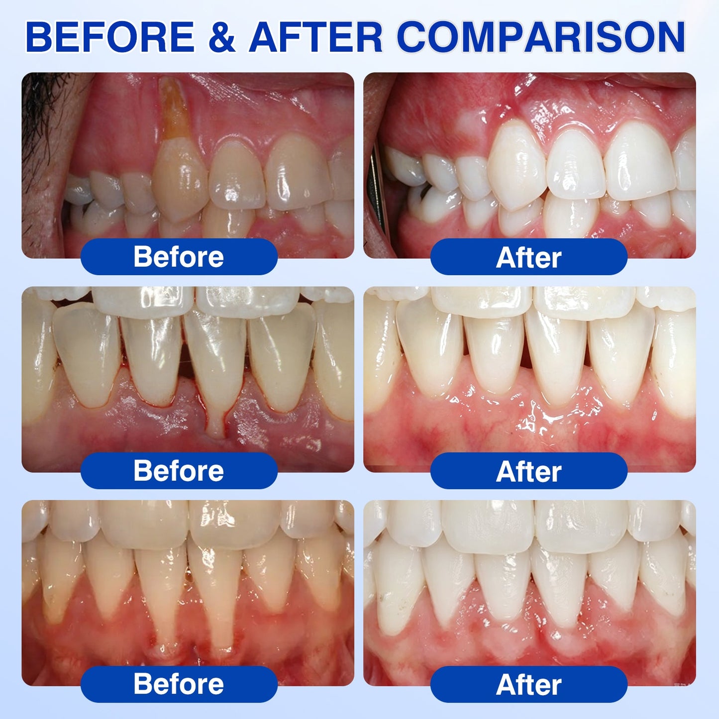 🇺🇸🏅🦷💫𝐍𝐚𝐭𝐫𝐚𝐯𝐨𝐫® GumRevive Periodontal Repair Gel