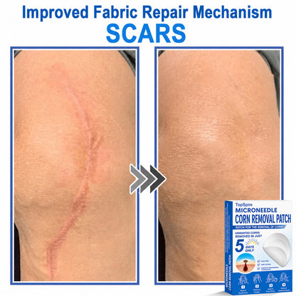 💖TopSpire® 2-in-1 Microneedle & Hydrocolloid Patch | Targeted Solution for Raised Moles, Acne, Flat Warts & Skin Tags | Helps Improve the Appearance of Fine Lines, Scars & Skin Imperfections | Invisible Star Pimple Patches for Face & Body