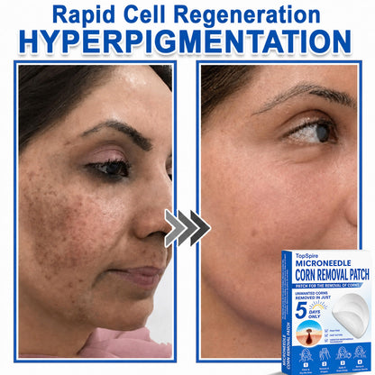 💖TopSpire® 2-in-1 Microneedle & Hydrocolloid Patch | Targeted Solution for Raised Moles, Acne, Flat Warts & Skin Tags | Helps Improve the Appearance of Fine Lines, Scars & Skin Imperfections | Invisible Star Pimple Patches for Face & Body