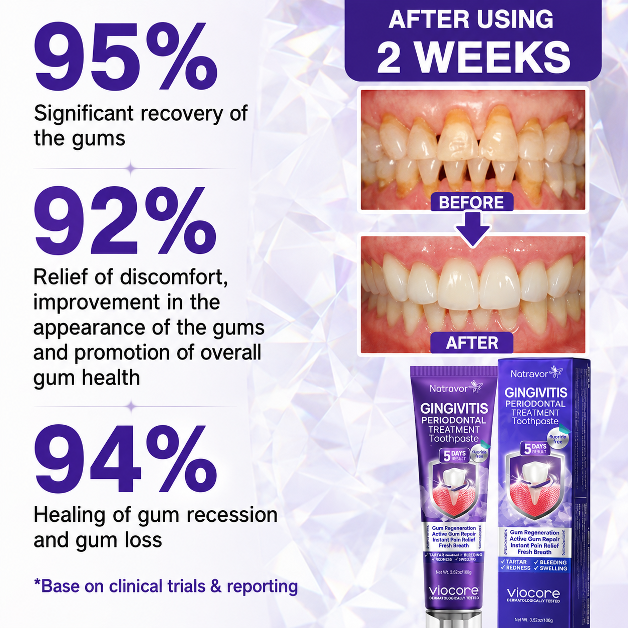 𝐍𝐚𝐭𝐫𝐚𝐯𝐨𝐫® VioCore Bee Venom Gingivitis & Periodontitis Treatment Toothpaste